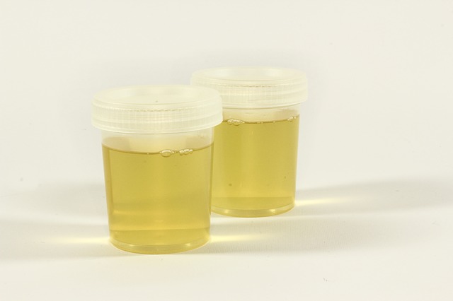 L’urine pourrait satisfaire 30% des besoins en engrais azotés de l’agriculture